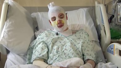 Photo of Uncle left with third-degree burns after running into burning building to save 8-year-old girl