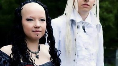 Photo of The Unconventional Couple’s Remarkable Transformation Since Their Wedding Becomes a National Conversation Ten Years Later