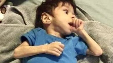 Photo of Mom Adopts Skeletal 7-Year-Old Orphan Near Death – Just Wait Until You See Him Today