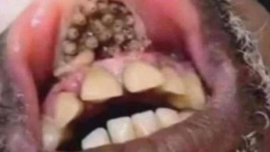 Photo of Understanding Common Dental Issues: Causes, Symptoms, and Prevention