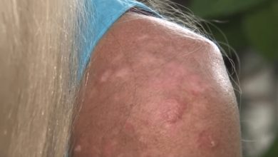 Photo of Woman left humiliated by nail salon after they refused to touch her hands