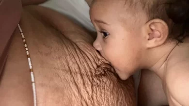 Photo of A Woman Shows the Raw Truth of Postpartum Bodies