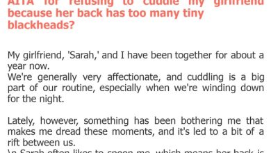 Photo of AITA for refusing to cuddle my girlfriend because her back has too many tiny blackheads?