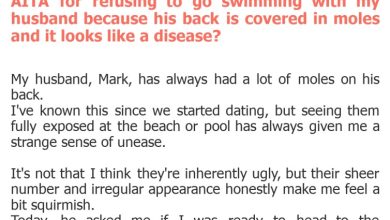 Photo of AITA for refusing to go swimming with my husband because his back is covered in moles and it looks like a disease?