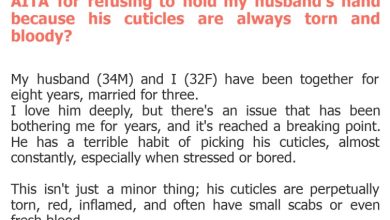 Photo of AITA for refusing to hold my husband’s hand because his cuticles are always torn and bloody?