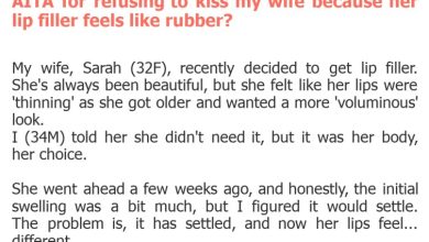 Photo of AITA for refusing to kiss my wife because her lip filler feels like rubber?