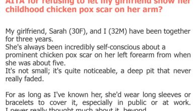 Photo of AITA for refusing to let my girlfriend show her childhood chicken pox scar on her arm?