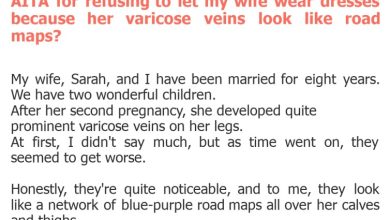Photo of AITA for refusing to let my wife wear dresses because her varicose veins look like road maps?