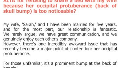 Photo of AITA for refusing to share a bed with my wife because her occipital protuberance (back of skull bump) is too noticeable?