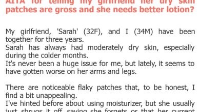 Photo of AITA for telling my girlfriend her dry skin patches are gross and she needs better lotion?