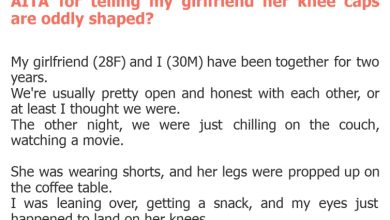 Photo of AITA for telling my girlfriend her knee caps are oddly shaped?