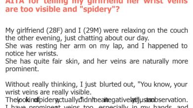 Photo of AITA for telling my girlfriend her wrist veins are too visible and “spidery”?
