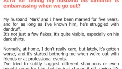 Photo of AITA for telling my husband his dandruff is embarrassing when we go out?