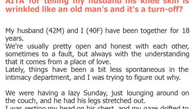 Photo of AITA for telling my husband his knee skin is wrinkled like an old man’s and it’s a turn-off?