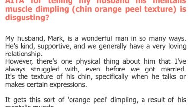 Photo of AITA for telling my husband his mentalis muscle dimpling (chin orange peel texture) is disgusting?