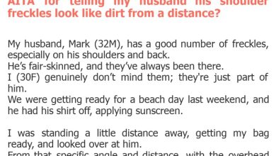 Photo of AITA for telling my husband his shoulder freckles look like dirt from a distance?