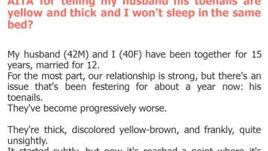 Photo of AITA for telling my husband his toenails are yellow and thick and I won’t sleep in the same bed?