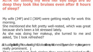 Photo of AITA for telling my wife her eye bags are so deep they look like bruises even after 8 hours of sleep?