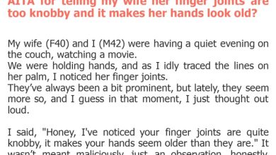 Photo of AITA for telling my wife her finger joints are too knobby and it makes her hands look old?
