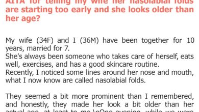 Photo of AITA for telling my wife her nasolabial folds are starting too early and she looks older than her age?