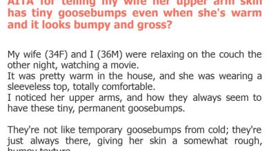 Photo of AITA for telling my wife her upper arm skin has tiny goosebumps even when she’s warm and it looks bumpy and gross?