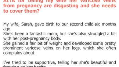 Photo of AITA for telling my wife her varicose veins from pregnancy are disgusting and she needs to cover them?